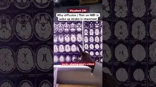 #icushort