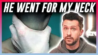 I Was Almost Strangled, Here's What Happened... 