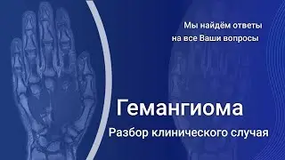МРТ лучезапястного сустава