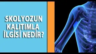 Skolyoz Kalıtsal Bir Hastalık mıdır?