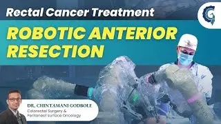 Robotic Rectal Cancer Resection in A Male Patient Following Short Course Radiation