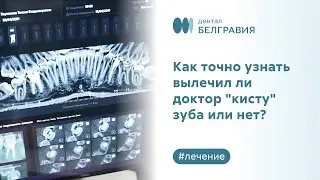 🦷 Как точно узнать вылечил ли доктор 