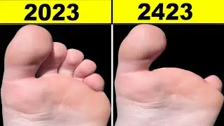 13 Body Parts That Will Disappear One Day