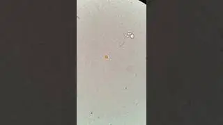 Артемия в соленом озере 