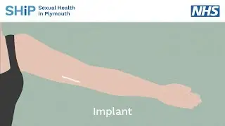 Having a contraceptive implant fitted