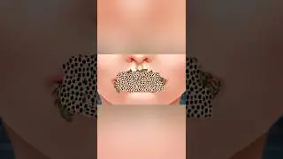 unbelievable trypophobia asmr