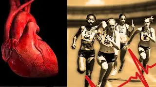 Coração do atleta (Fisiologia do exercício)