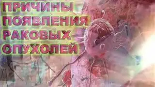 Три причины вознекновения рака