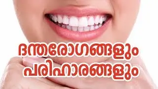 dental problems and solutions in malayalam | ദന്ത പ്രശ്നങ്ങളും പരിഹാരങ്ങളും