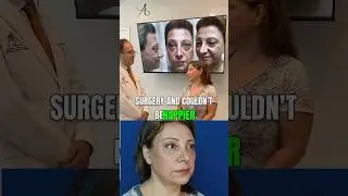 Long Term Results of  A Female Middle Eastern Rhinoplasty!