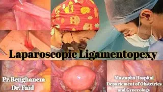 Ligamentopexie antérieure: Traitement coelioscopique d'un syndrome de congestion pelvienne