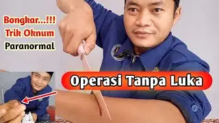 Trik Oknum Paranormal – Operasi Tanpa Luka