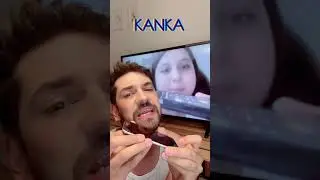 Bedelini Ödeyeceksin Kanka! | Ekranönü | Ozan Varol 