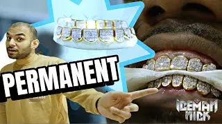 $40,000 Permanent Invisible set grill