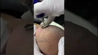 Кератолитик Pink Royss скоро в продаже 