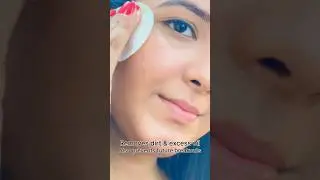 Best solution for you skin🕊️ #lelystad #lely #acne #pimplesremoval  #trending #viral #shorts