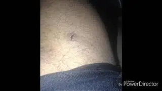 Myers (CGE) shows his wound from an "own goal"