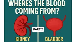 Hematuria in Children: How to Identify the Site of Bleeding (Kidney vs Bladder) | Blood in Urine