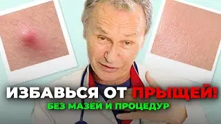 Прыщи уходят сами: узнайте истинные причины и как избавиться без мазей и процедур
