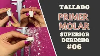 Tallado en cera de primer molar superior derecho | Odontologia con Cri