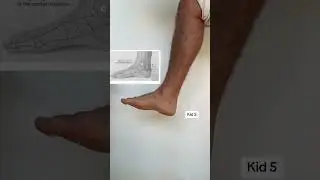 Цистит 