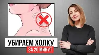 ХОЛКА уйдет навсегда! ВДОВИЙ ГОРБ - упражнения и МФР