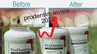 PRODENTIM - Prodentim Review - Prodentim Reviews - Prodentim Ingredients - Prodentim Supplement