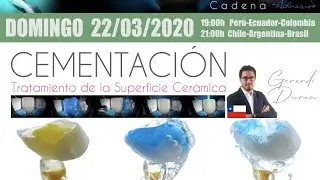 CONVERSATORIO 2 | Cementación y tratamiento de la superficie cerámica | Gerardo Durán
