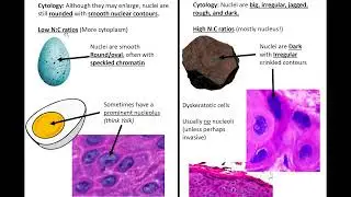 Squamous Mucosa of the Upper Aerodigestive Tract: Kurt's Notes #pathagonia