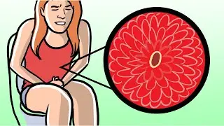 The Secret of American Diet Sandwich Problem