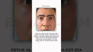 🔹Burun ichidagi tuklarni olib tashlashga shoshilmang… #foydali #shifo #animation #doktor