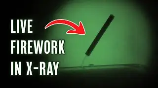Fluoroscopy - Real time X-ray vision