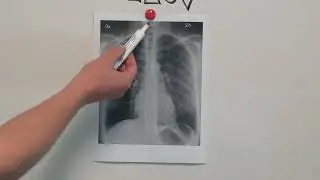 How to Read a Chest X-Ray: ABCDEFG