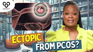 Can PCOS Cause Ectopic Pregnancy