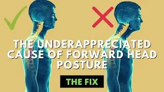 The Underappreciated Cause of Forward Head Posture - The Fix