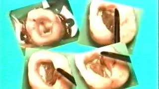 Основы Практической Эндодонтии. Учебный фильм