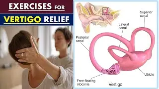 Vertigo Treatment- How To Get Rid Of Spinning, Dizziness?| Vertigo Exercises To Do At Home (Part-2)