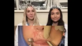 Facial Surgery Adjuncts with Sam&Meg