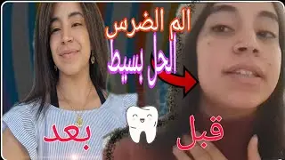 ضرتني الضرسة و نفخت ليا وجهي و عييت من الادوية //  الحل بسيط .