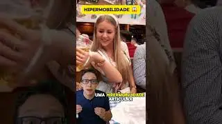 Hipermobilidade 😱🤸‍♀️ 