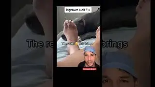 Cotton ball trick is pretty slick…for an ingrown nail 