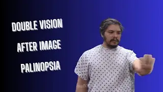 Double Vision and After Image IMPROVED with Dr Suh