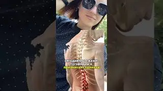 👩‍⚕️Сколиоз — деформация позвоночного столба в 3-х плоскостях, по типу буквы «S», «C» или «Z» 👇