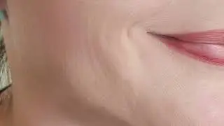 topfold