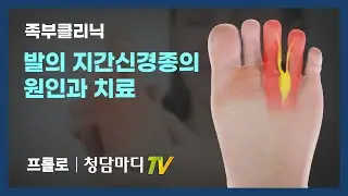 발가락통증_발의 지간신경종의 원인과 치료_청담마디신경외과 심재현원장