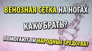 Как убрать и предотвратить венозную сетку на ногах