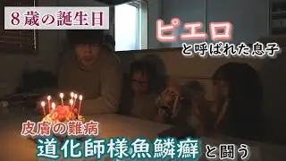 【最新話】皮膚の難病と闘う～足の痛みと向き合う中、家族で迎えた誕生日～配信型ドキュメンタリー「ピエロと呼ばれた息子」第１３３話