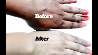 How To Use Gram Flour For Skin Whitening