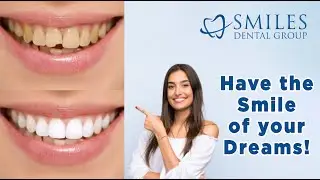 How to transform your Smile with Cosmetic Dentistry (2021)