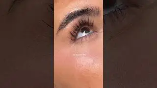 a reminder that all skin texture is normal